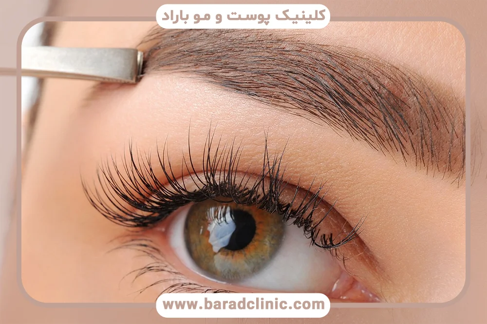 برای کاشت ابرو از کجا مو برمیدارن