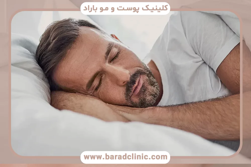 نقش کم خوابی در ریزش مو