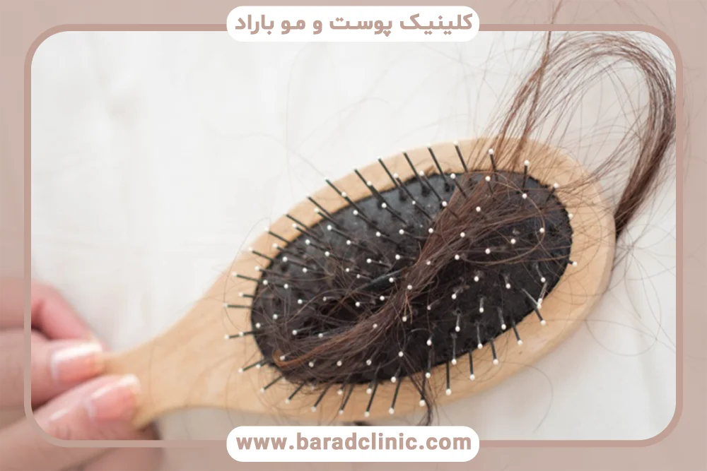 ریزش مو و استرس