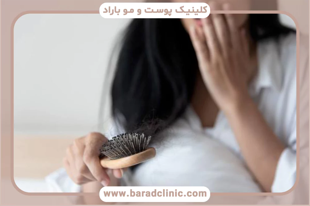 ریزش مو و بارداری