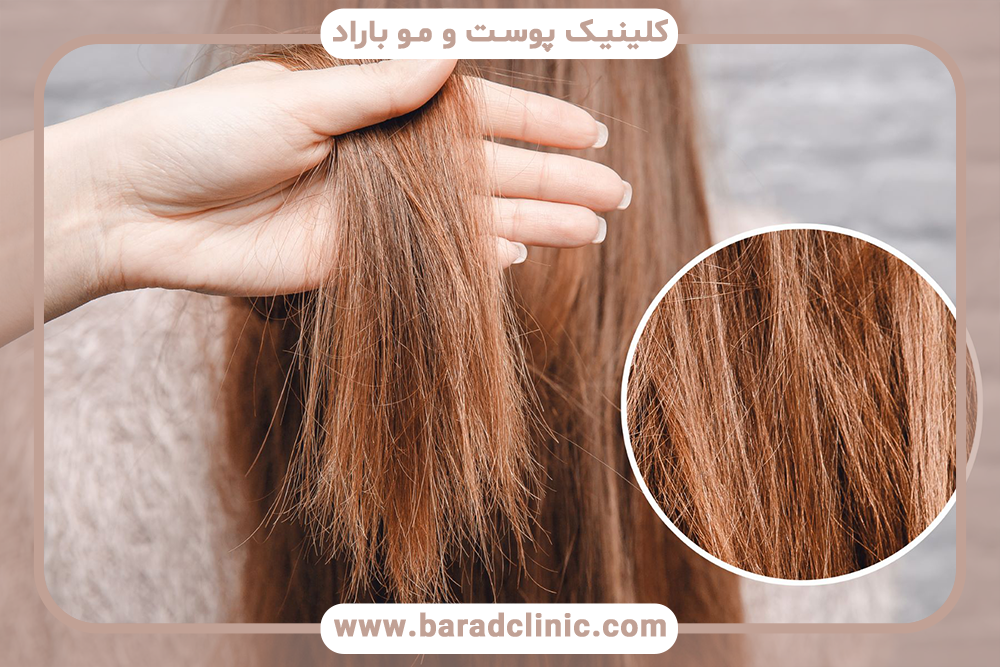 اثر UV بر مو