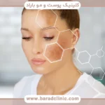 استروژن و لک های پوستی