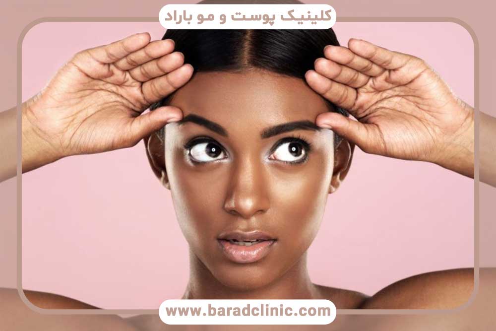 کاشت ابرو دخترانه