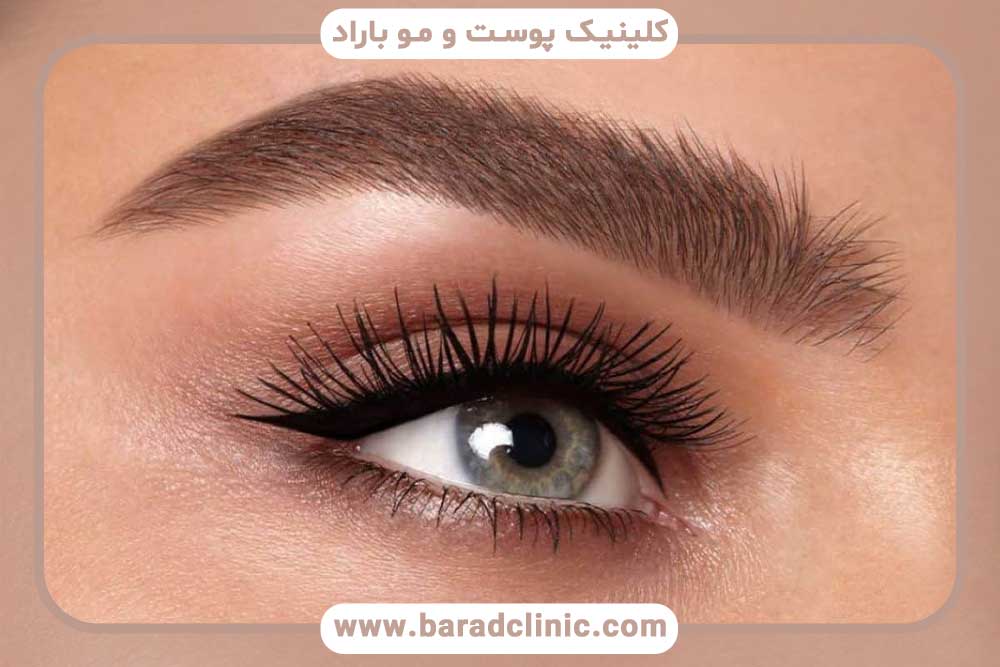 کاشت ابرو اقساطی در شمال تهران