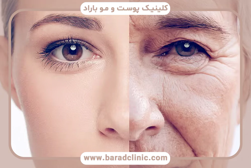 التهاب مزمن خفیف پوست دشمن خاموش پیری شتاب یافته