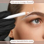 کاشت ابرو اقساطی بهترین کلینیک شمال تهران
