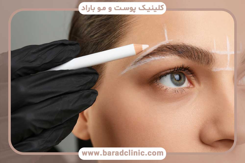 کاشت ابرو اقساطی بهترین کلینیک شمال تهران