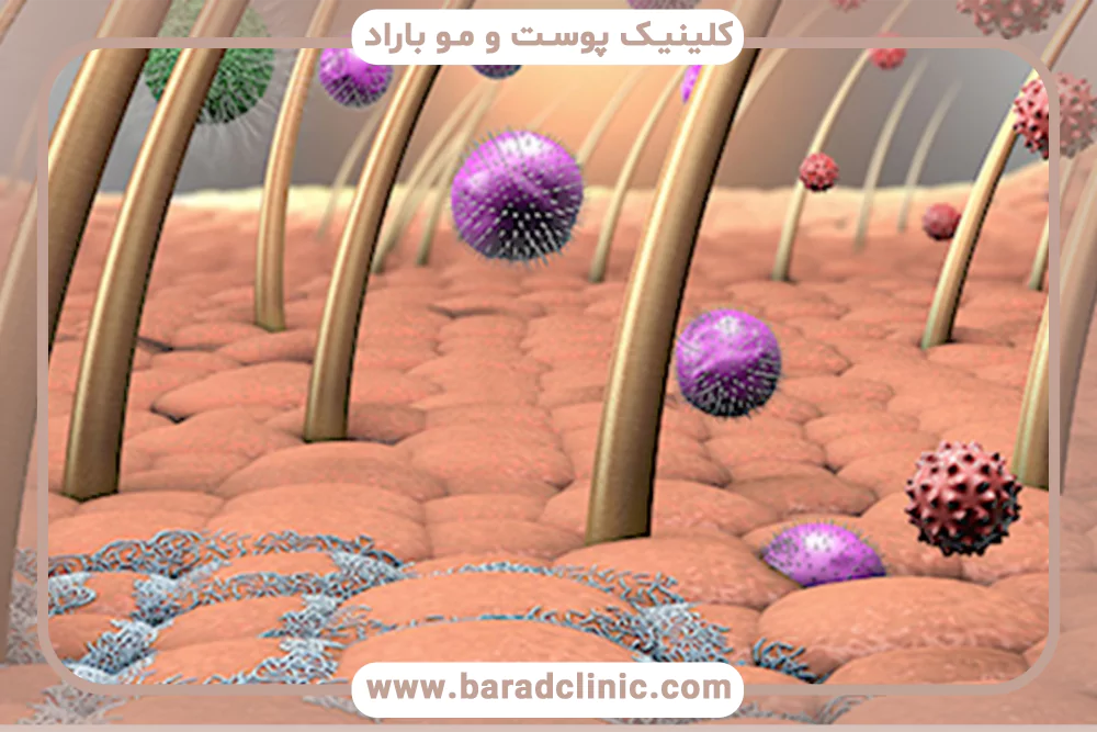 سد دفاعی پوست