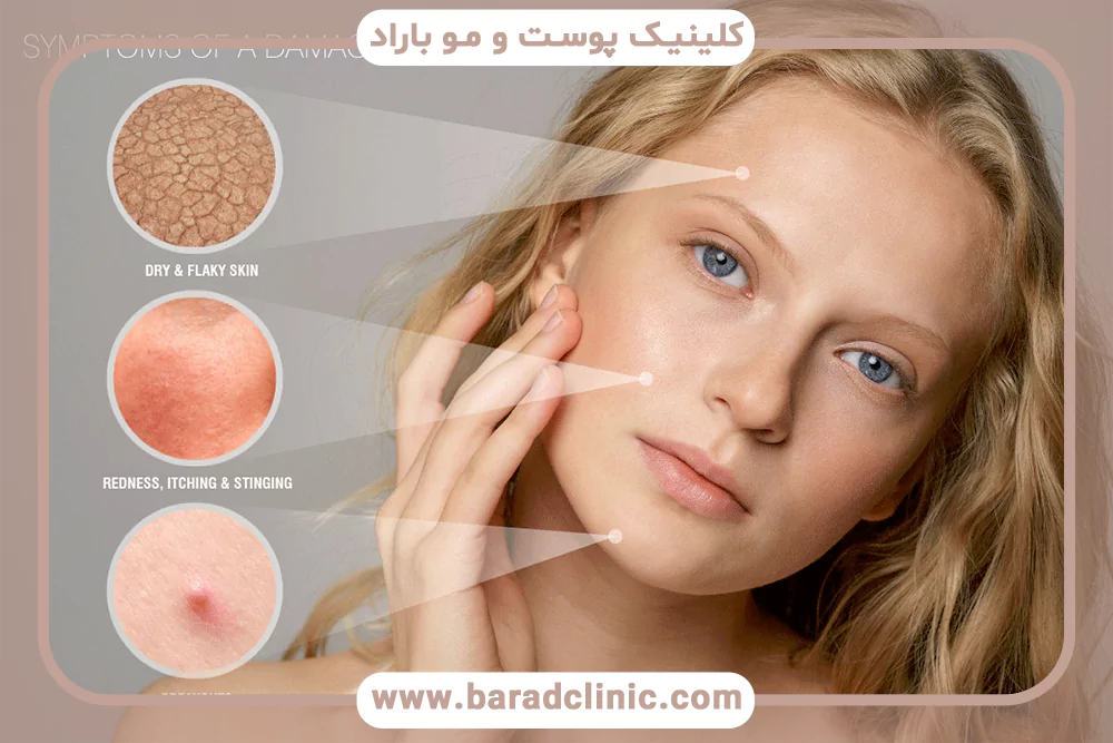 سد دفاعی پوست