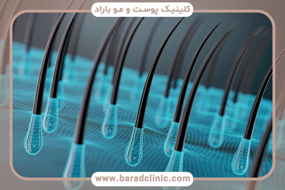 فولیکول مو