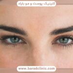 کاشت ابرو دخترانه با موی بلند