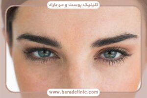 کاشت ابرو دخترانه با موی بلند