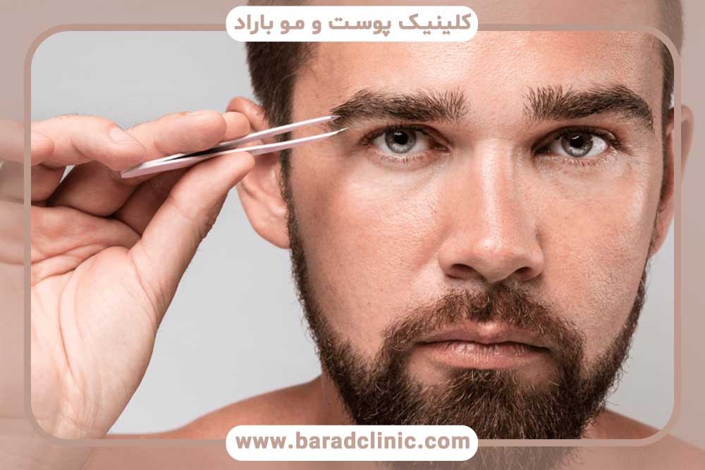 کاشت ابرو مردانه قسطی