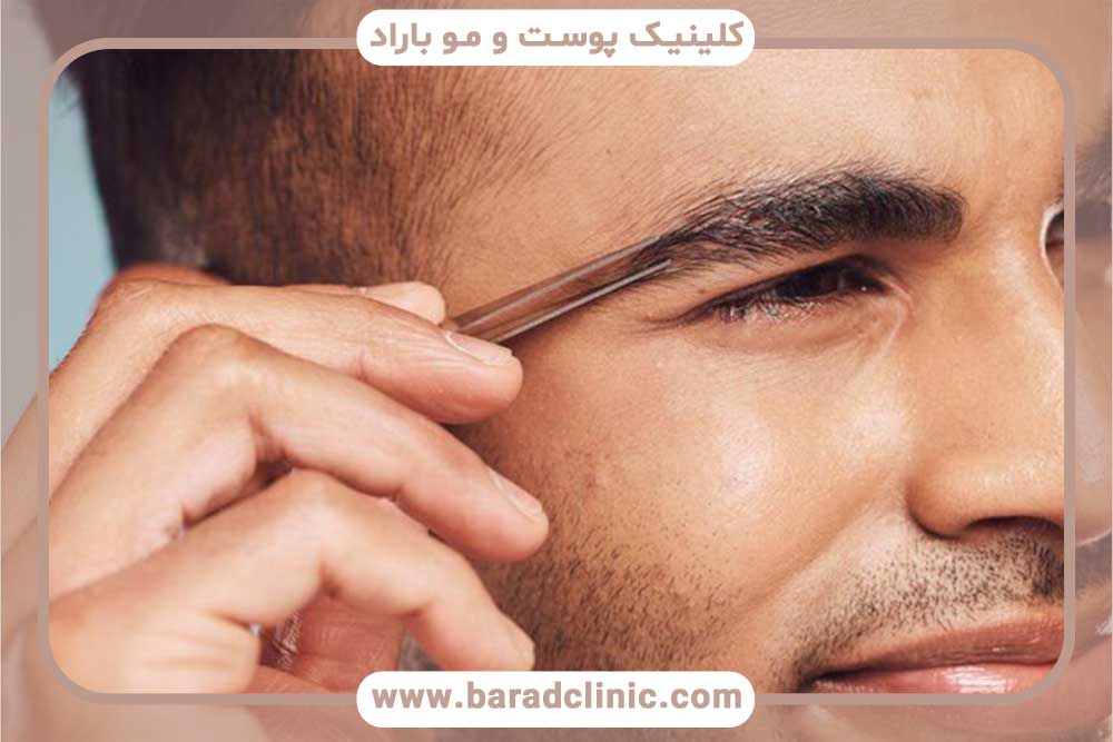 قیمت کاشت ابرو مردانه