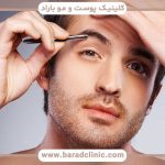 قیمت کاشت ابرو مردانه تهران