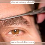 قیمت کاشت ابرو طبیعی مردانه