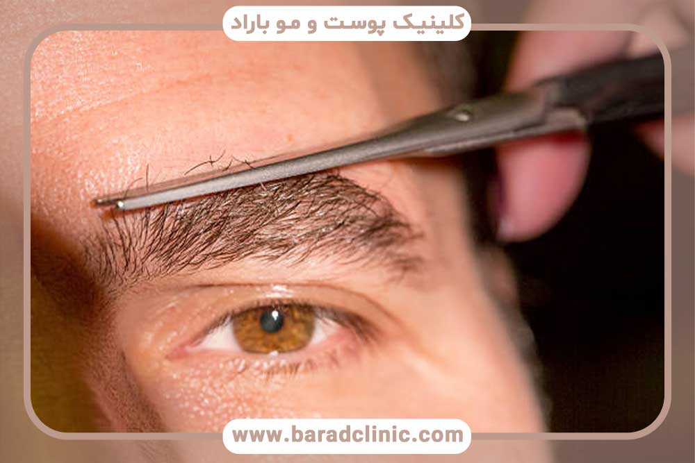 قیمت کاشت ابرو طبیعی مردانه