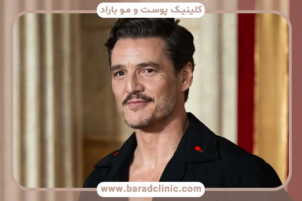 هزینه کاشت سبیل