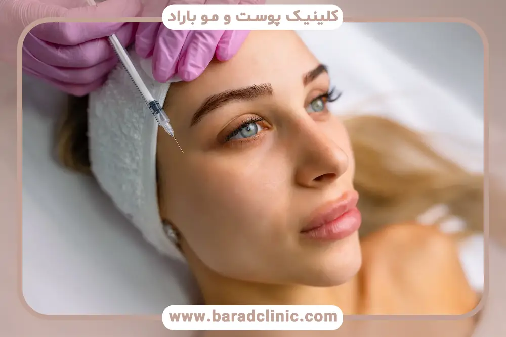 بوتاکس ابرو قبل و بعد