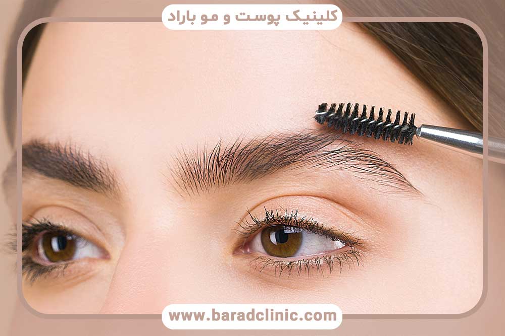 کاشت ابرو پهن با موی بلند