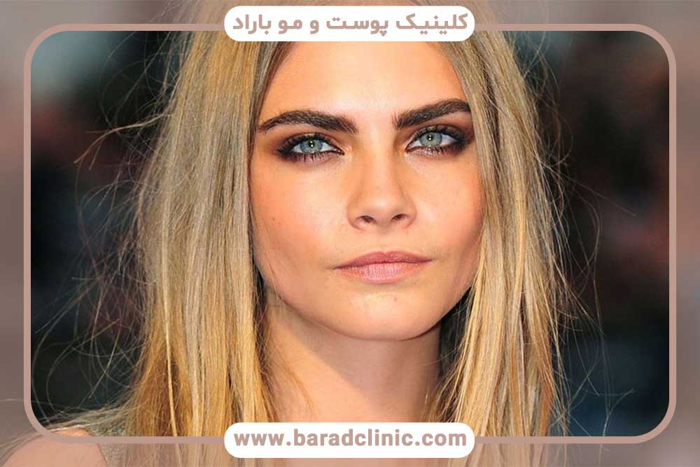 کاشت ابرو دخترانه برای صورت کشیده قسطی