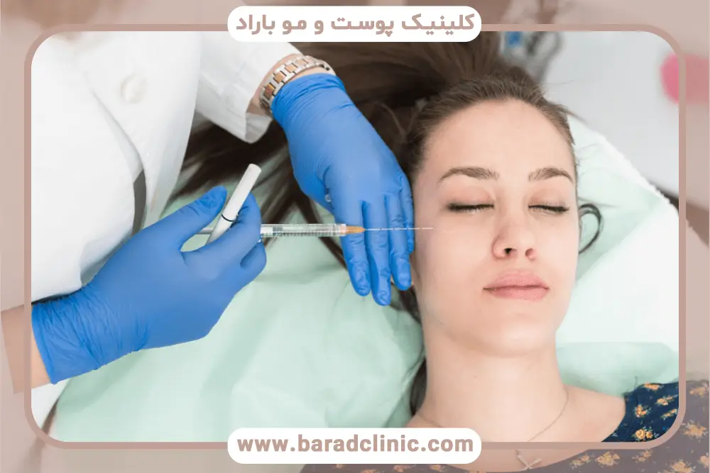 کاشت ریش روی تتو