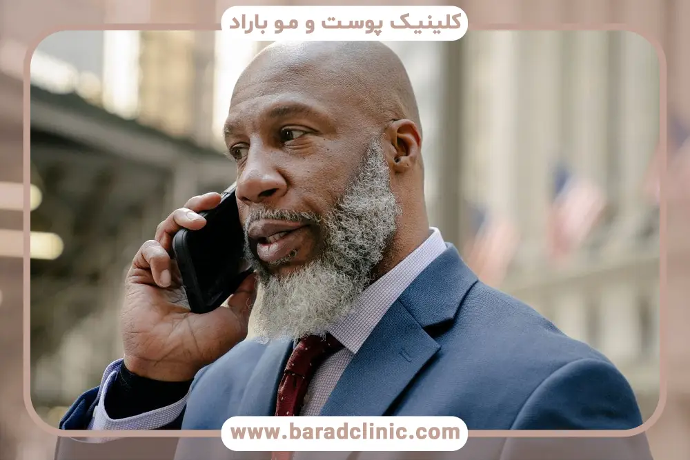 ماندگاری کاشت ریش