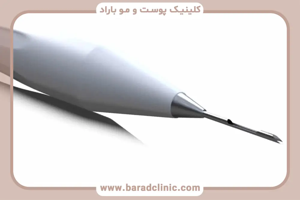 ابزار کاشت مو