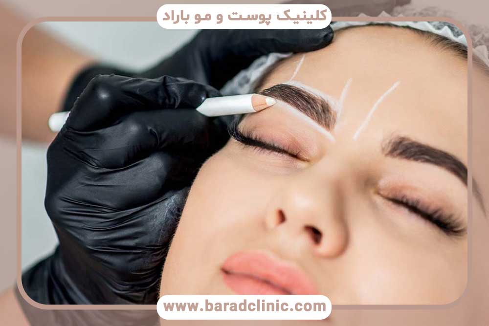کاشت ابرو اقساطی بهترین کلینیک تهران