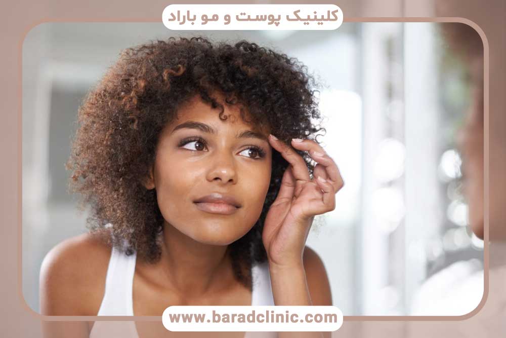 کاشت ابرو دخترانه برای صورت کشیده