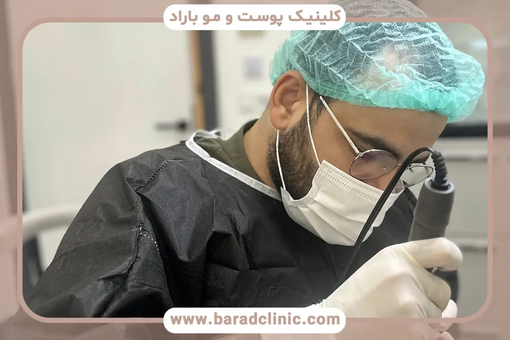 کاشت مو بلند