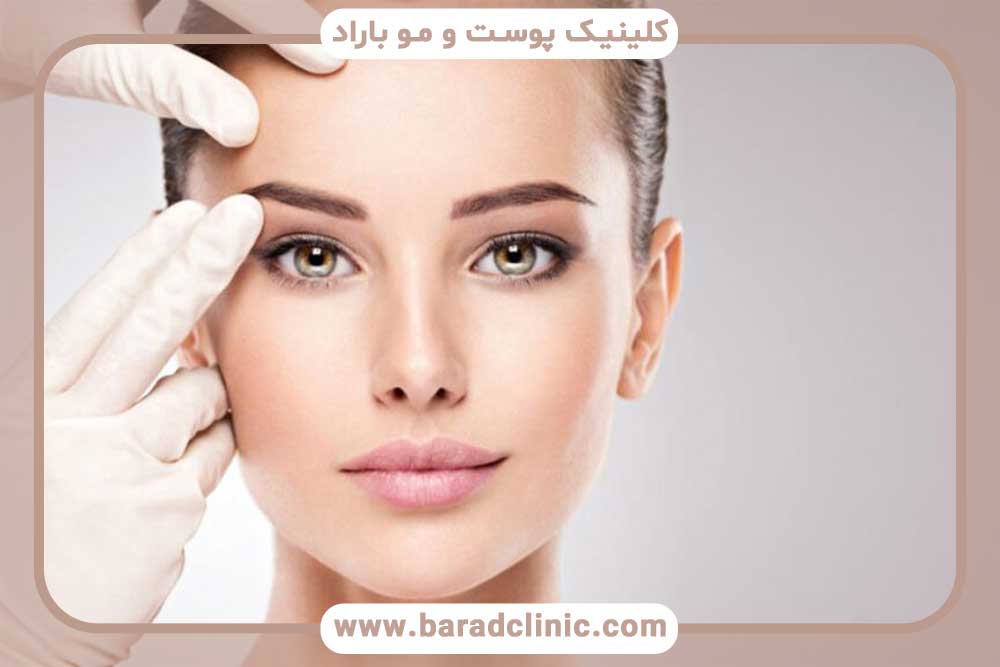 کاشت ابرو دخترانه برای صورت کشیده تهران