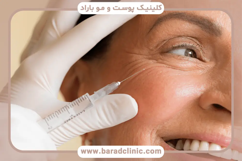 بوتاکس صورت قبل و بعد