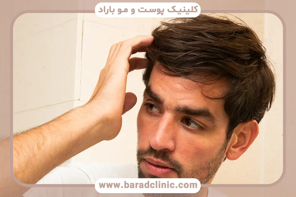 پروسه کاشت مو
