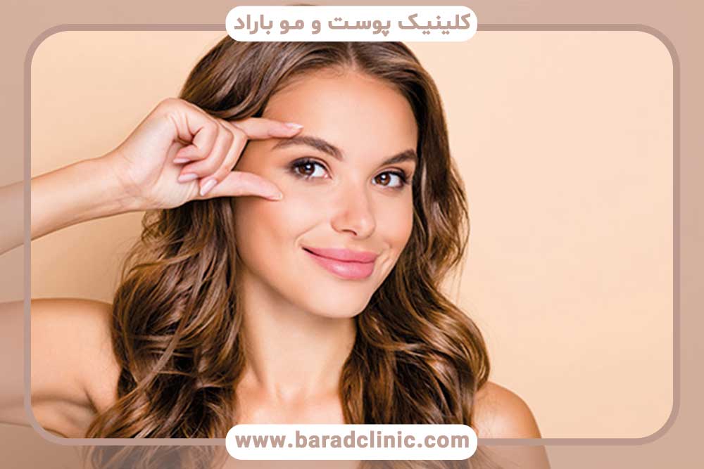 کاشت ابرو با موی بلند تهران