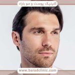 کاشت ابرو طبیعی مردانه تهران