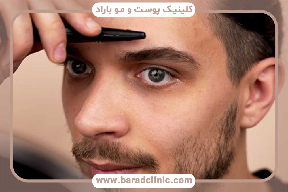 کاشت ابرو مردانه قسطی تهران