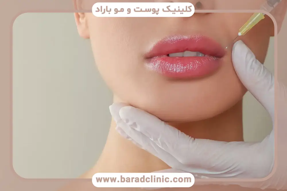 بوتاکس لب چیست؟