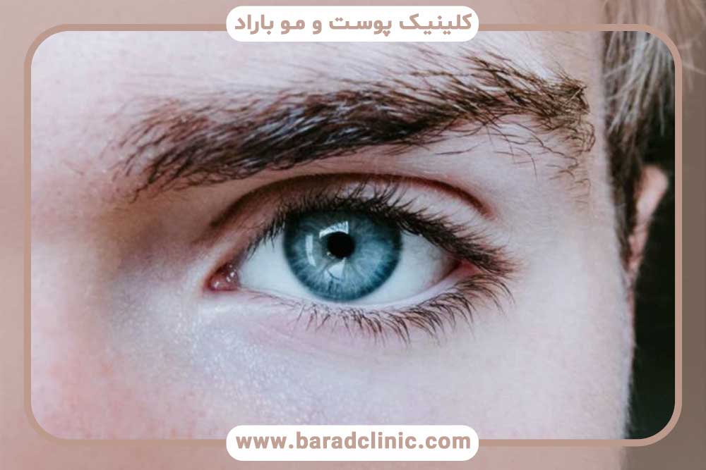قیمت کاشت ابرو طبیعی مردانه
