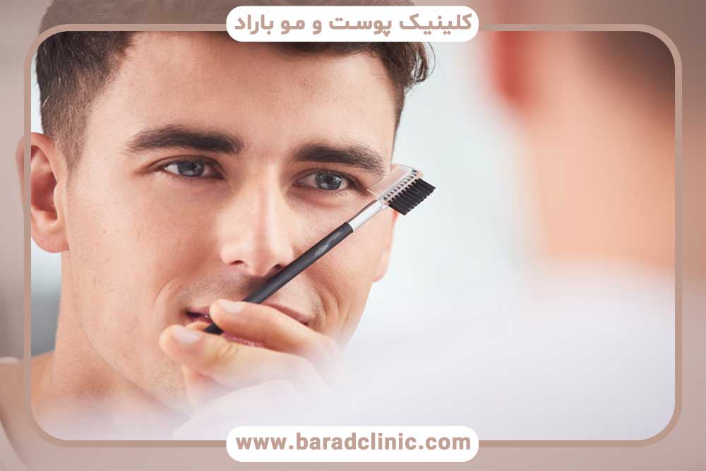 قیمت کاشت ابرو طبیعی مردانه تهران