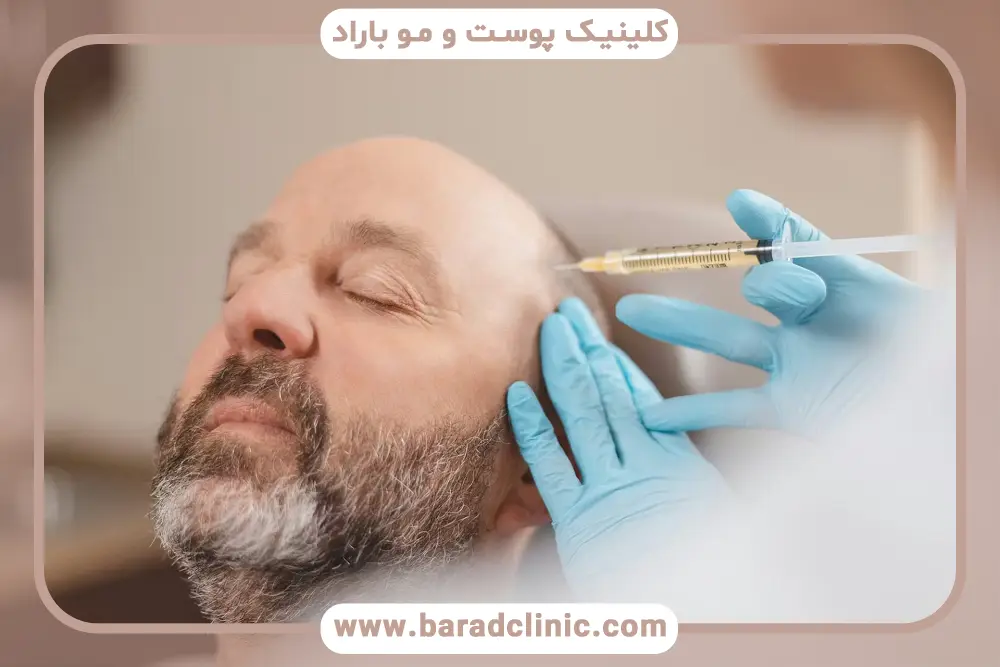 میانگین هزینه PRP مو