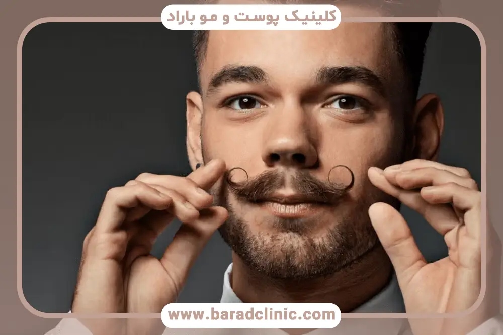 عوامل موثر بر ماندگاری کاشت سبیل