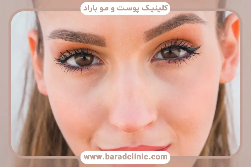 عوامل موثر بر هزینه جراحی بلفاروپلاستی تحتانی تهران