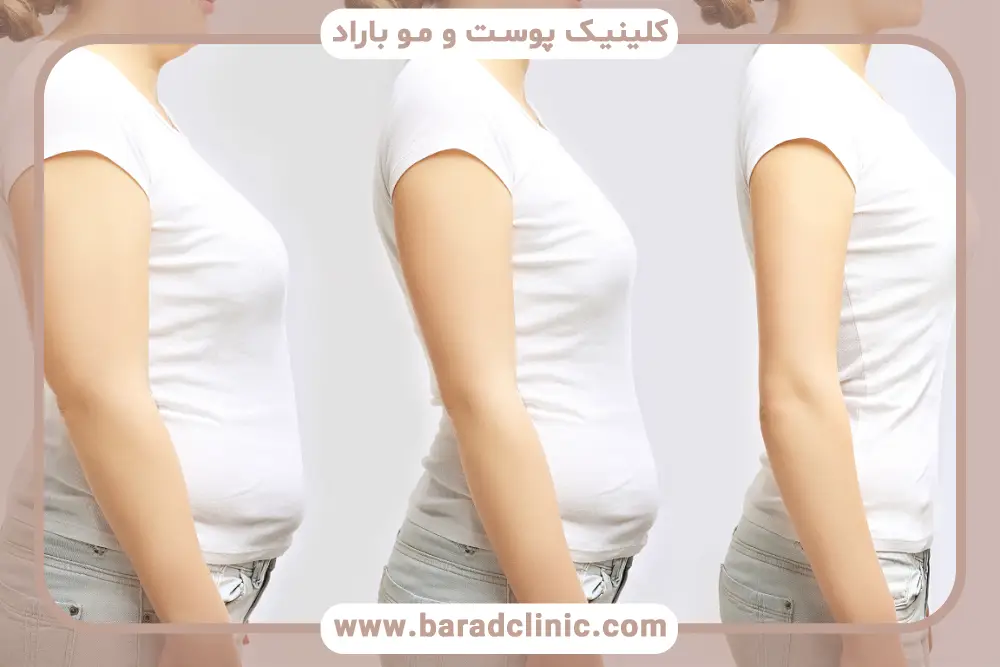 چه بیماری باعث لاغری میشود؟ تیروئید