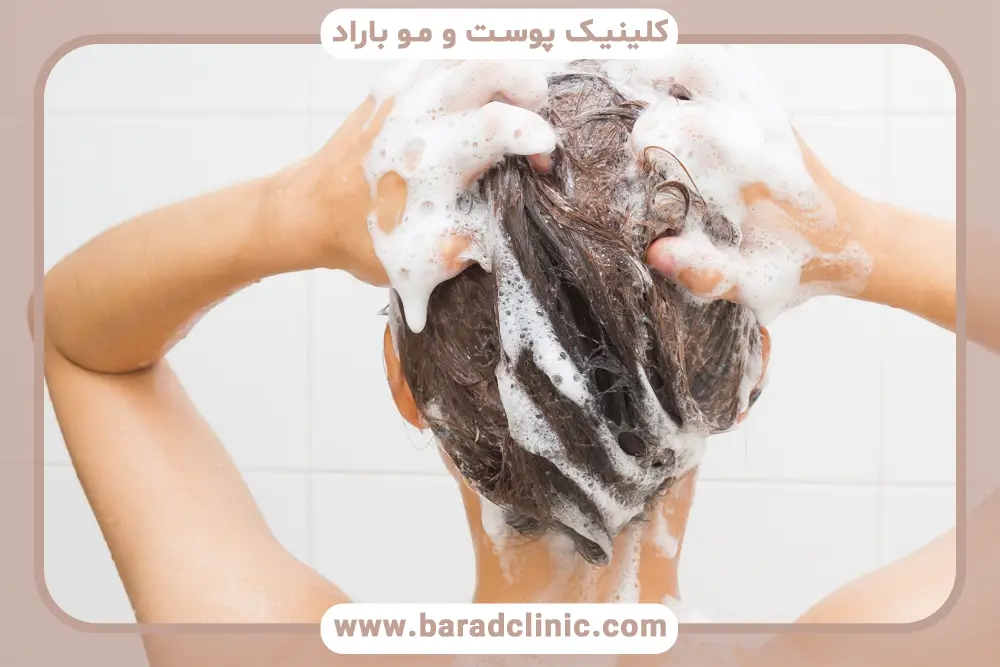 اهمیت حمام بعد از کاشت مو