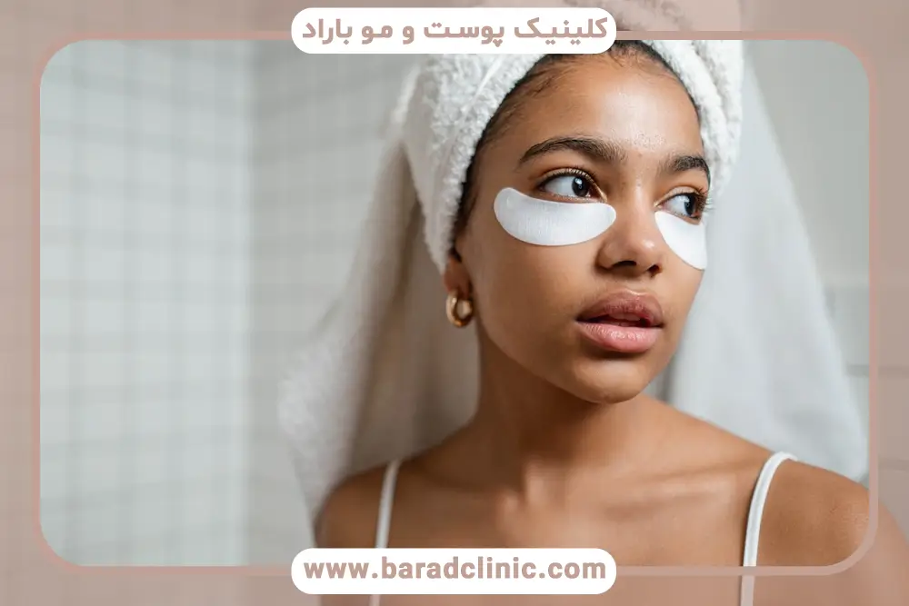 بوتاکس زیر چشم چیست؟