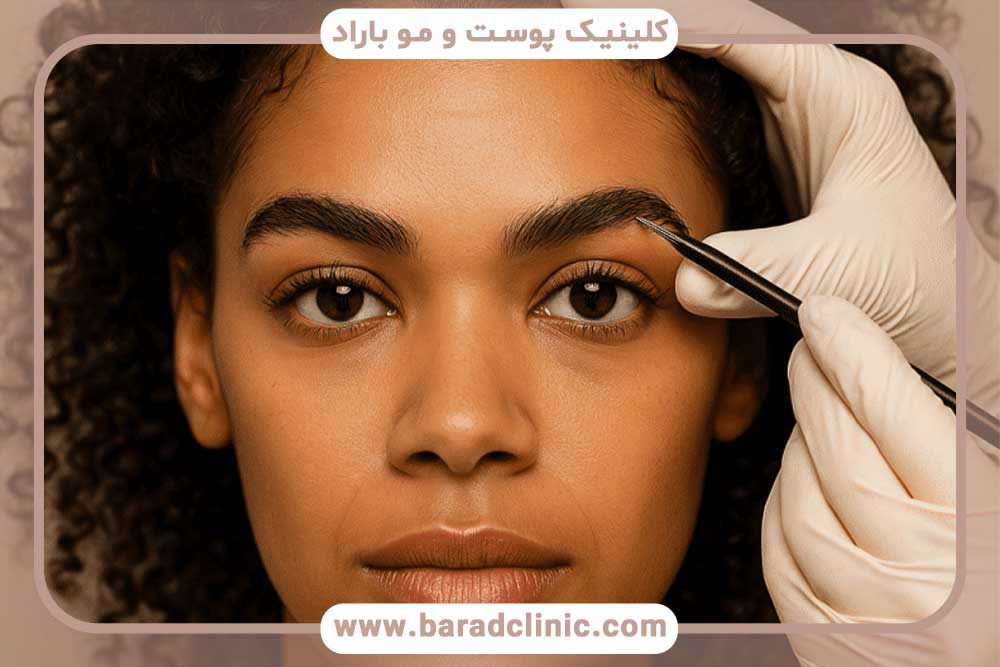 کاشت ابرو دخترانه برای صورت کشیده