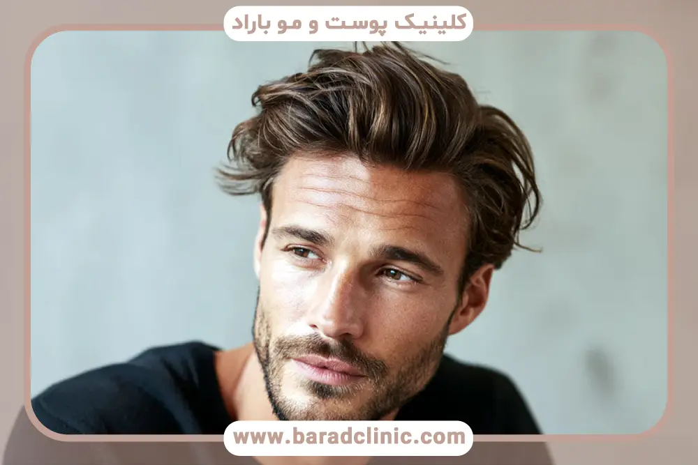 هزینه بالا از مهم‌ترین معایب کاشت مو