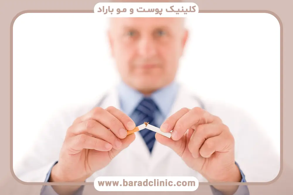 تاثیر سیگار و مشروب بعد از کاشت مو