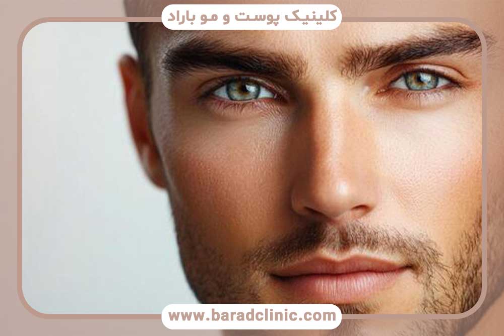 قیمت کاشت ابرو مردانه تهران